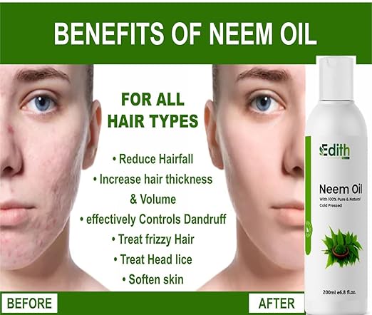 Neem Oil For Anti-Dandruff (200 ml)